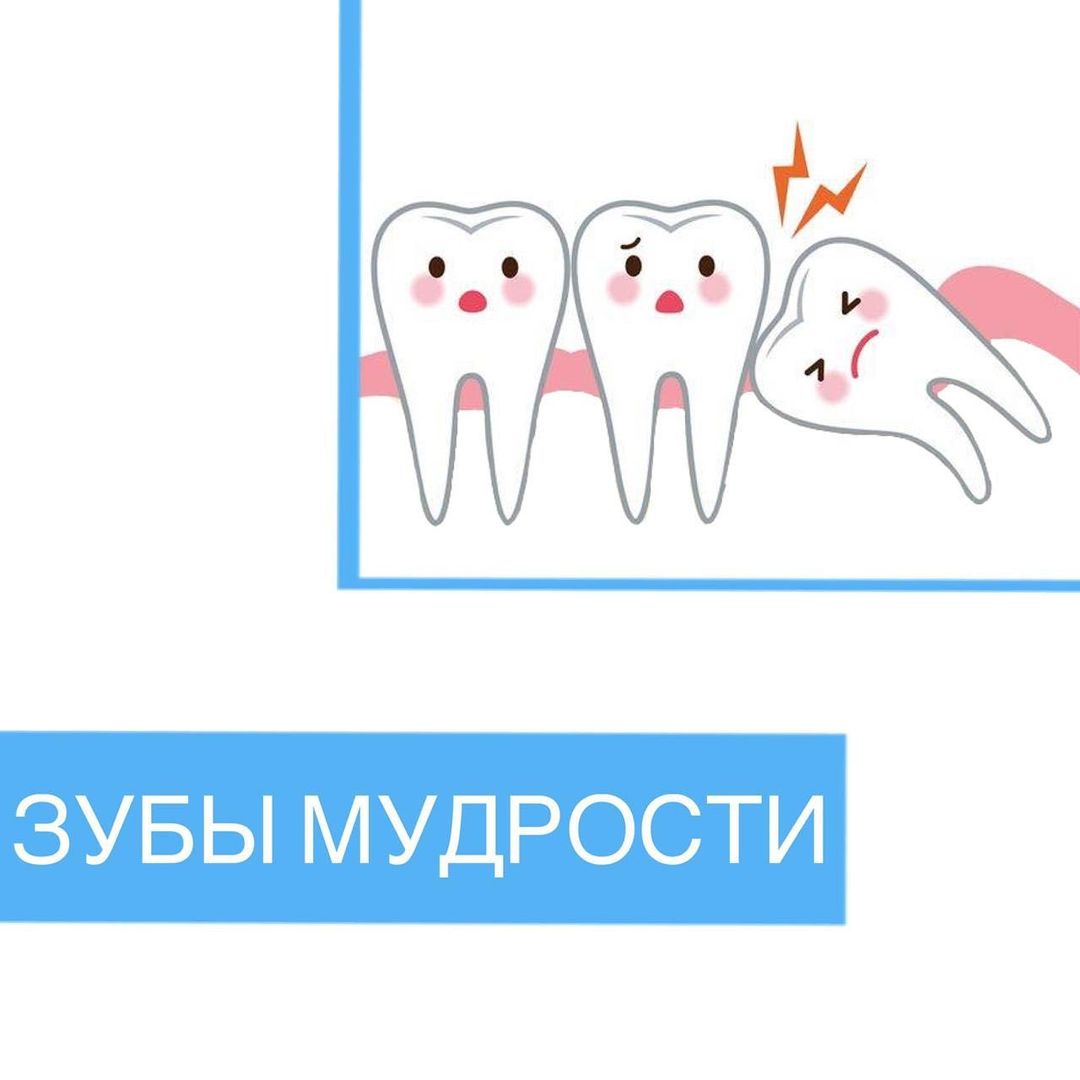 Зубы мудрости. Оставлять или удалять?